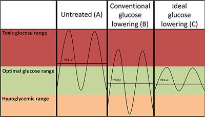 Postprandial Glucose Spikes, an Important Contributor to Cardiovascular Disease in Diabetes?